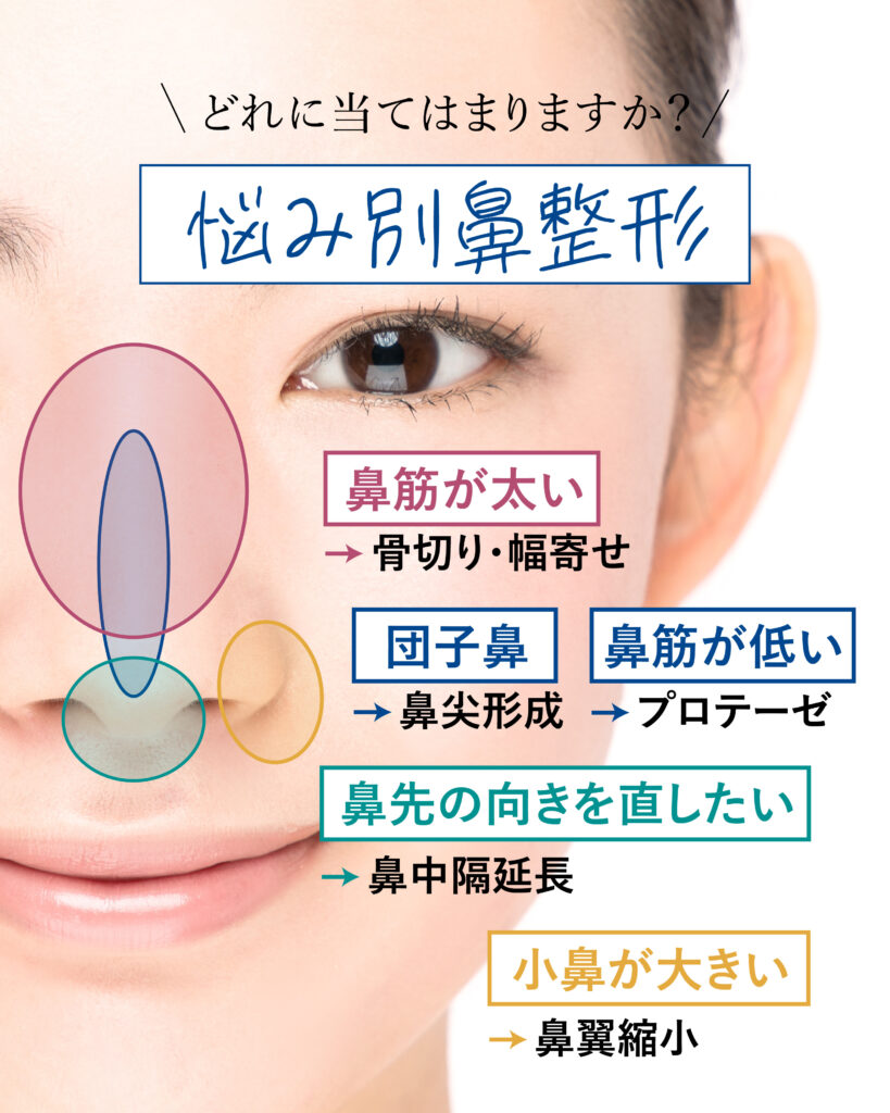鼻翼 悩み別！鼻整形の種類について解説 | コントアクリニック東京