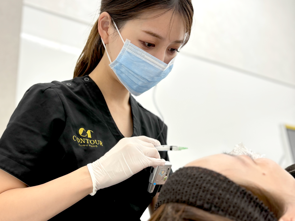 医師によるジュベルックの手打ち注入。注入量や深さを調整しながら肌悩みに合わせて施術を行う様子
