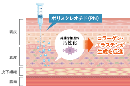 リジュランの主成分であるポリヌクレオチドを肌に投与することで、真皮層の線維芽細胞を直接活性化し、コラーゲン・エラスチンの生成を促進する図