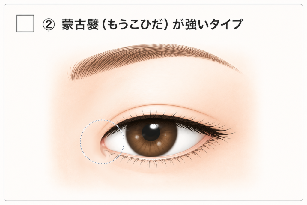 蒙古襞が発達している目頭の解剖イラスト